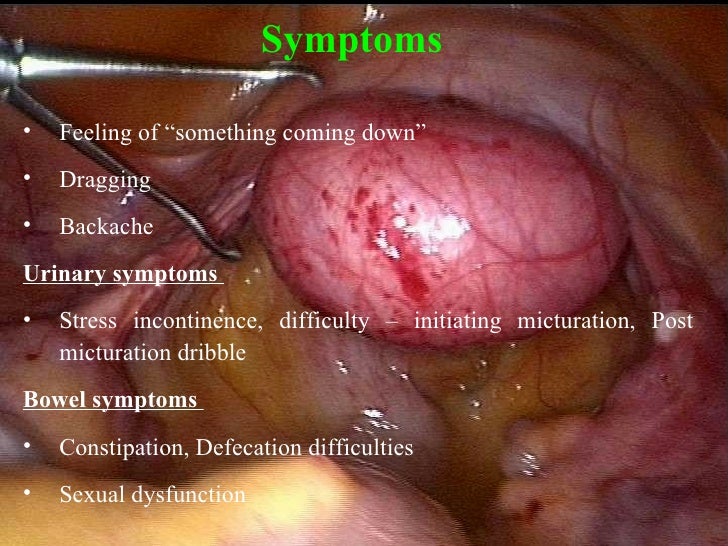 photo of vaginal operations Photo of vaginal operations